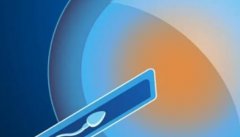 上海试管医院汇总，试管前需要做这些