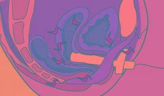 全国试管技术哪里好?试管哪个地方更先进?