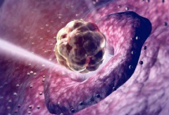 做试管也无法避免生化妊娠！胚胎质量是关键！