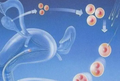 单侧卵巢做试管如何提高成功率，心态调整很重要！