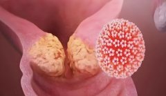 试管移植失败要怎么做?试管移植失败后如何成功?