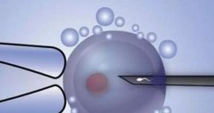 珠海做三代试管的申请条件，手续及流程汇总