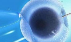 西宁三代试管医院怎么样？注意这些风险和事项