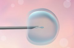 收藏！苏州试管的项目及费用明细速览