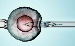 什么是试管技术？福州做试管选性别的医院推荐