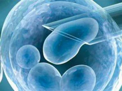 北京试管医院权威排名与成功率深度剖析：为您精选最优生殖健康选择