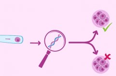 四川做三代试管的医院费用明细介绍，注意选取正规专业的医院