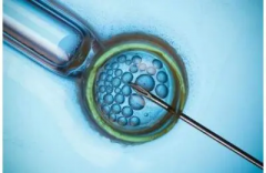 上海中山医院试管费用全攻略：最新助孕套餐，价格亲民详解