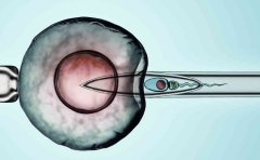 西宁做试管包成功的成功率有多少？