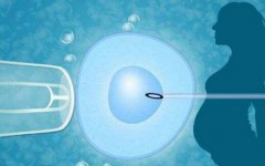 一文了解国内三代试管费用构成及具体明细