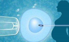 什么是三代试管？湘潭市中心医院三代试管技术分析