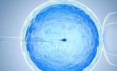 三代试管送检的详细介绍，三代试管送检筛查通过与数量无关的原因