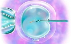 马来西亚试管全流程，马来西亚试管常见问题解答