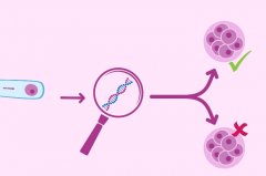 影响试管费用的因素，试管流程介绍