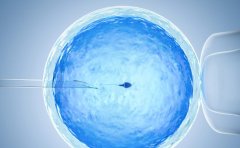 什么是试管技术？上海市常见的试管医院推荐