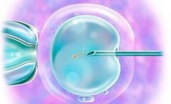 上海试管医院介绍，试管手术后需要注意的事项