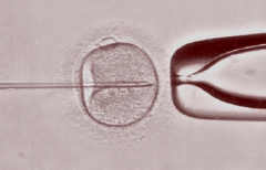 精打细算试管路：2024年费用一览，让你少走弯路
