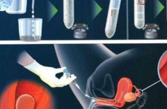 收藏！带你提前了解淄博三代试管流程及费用概况