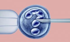 世界各国发展试管技术，这些国家试管技术名列前茅