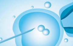 试管技术中存在这些差别，分析不同技术的优缺点