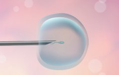 新鲜精子与试管婴儿的成功率是否相关？与冷冻精子有什么不同？