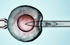 试管需要注意事项，输精管结扎后使用试管的成功率介绍