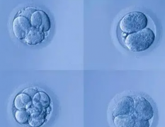 高龄女性孕期需谨慎，揭秘怀孕风险与保胎要略