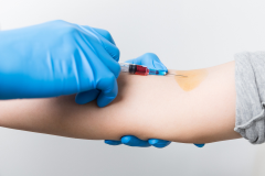 试管疗程中的注射安排：揭秘频次、时间与是否需每日就医