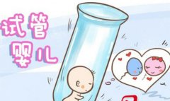 做试管需要的时间分析，选择试管医院需要考虑这些