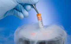 做试管要打多久的针？要服用什么药物？