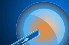 试管技术的基本流程，试管前的注意事项