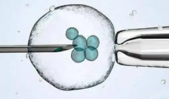 试管失败率有多高？教你几招降低风险！