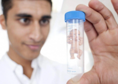 女性做试管大致的费用是多少？