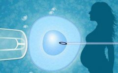 丽水试管助孕成功率排名，助孕成功率高的意义