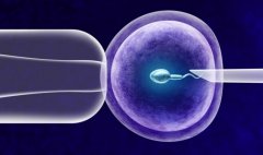 试管自然周期方案的适用人群及治疗流程