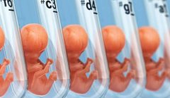 二代试管费用高吗？二代试管的适用人群