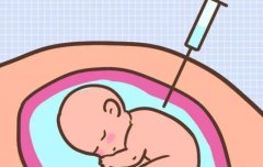 试管的技术及详细步骤，需要做试管的情况分析