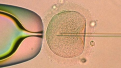 汕头市中心医院试管花费，省钱小妙招助你轻松应对！