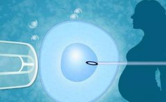 三代试管需要哪些具备条件？有哪些要求？