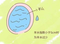 羊水少别担心，科学补救方法助你安心待产