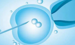 二代试管：好处与隐患并存，你了解多少？