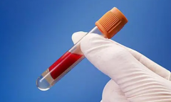 双卵泡移植新突破！上海这些医院助您圆梦试管