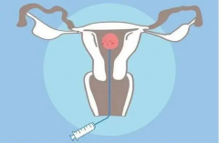 试管要取多少卵子才够？一次讲清卵子数量需求