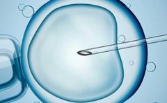 福州三代试管是否会生侏儒？福州三代试管的优势