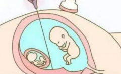 <b>试管移植前新发现：宫腔镜检查助力，提升成功率显著优势！</b>