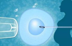 山西省人民医院试管治疗技术优势与特点