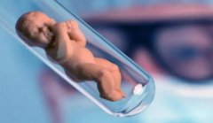 取完卵后可以进行试管的时间介绍，取完卵后需要注意什么？