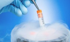 做试管卵泡25个的原理介绍，如何提高试管的成功率？