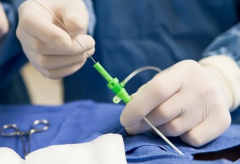 试管降调：揭秘关键步骤与注意事项