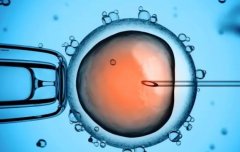 选择去日本做试管的优势介绍,还有这些注意事项